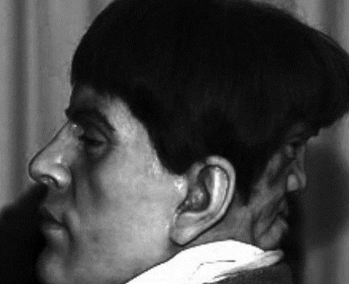 Une personne à double visage